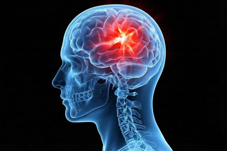 neuro